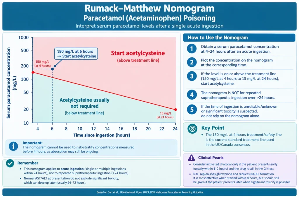acetaminophen poisoning clinical infographic chart evaluating the Rumack-Matthew nomogram, paracetamol toxicity treatment lines, and N-acetylcysteine administration guidelines for pediatric board exams.